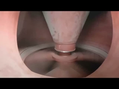 1 - mulino verticale del cemento di 45t/H VRM per la macinazione di materia prima